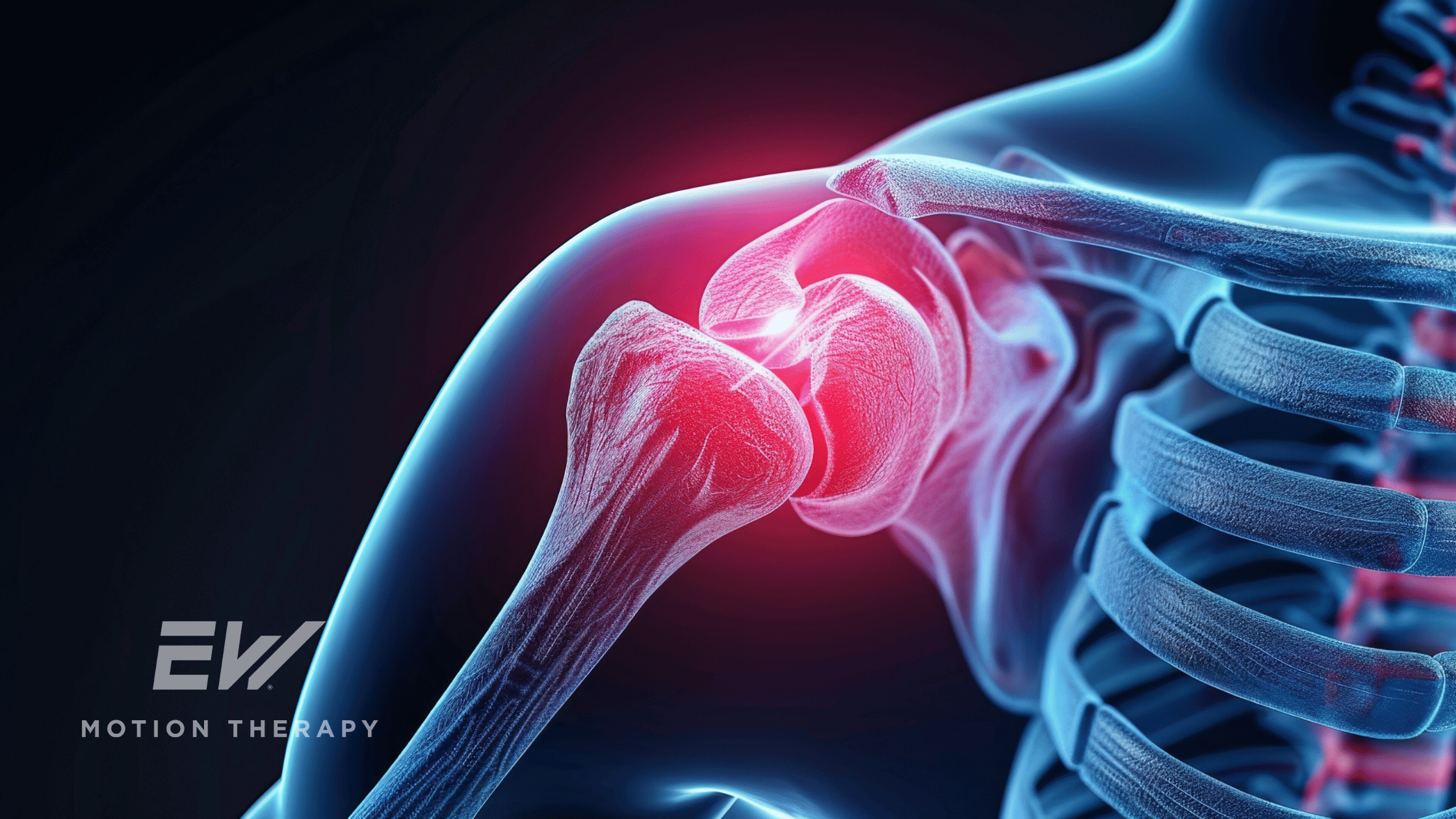 Understanding Shoulder Impingement: Causes, Symptoms, And Treatment